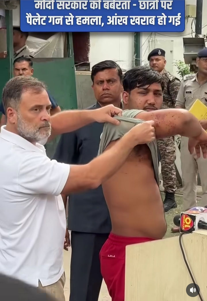 Photo caption by independentink.in copy desk: Rahul Gandhi showing  pellet gun marks on the body of Sahil on Friday, 24 July, 2026, Delhi. Sahil was marching with the tiranga (national flag) when he was hit by a pellet gun on 20 June, 2026.  His one eye has also been damaged. There have been other recorded cases of pellet guns being used on the day of the Jantar Mantar peaceful protests. This is the first time that pellet guns have been used by the security forces in Delhi.