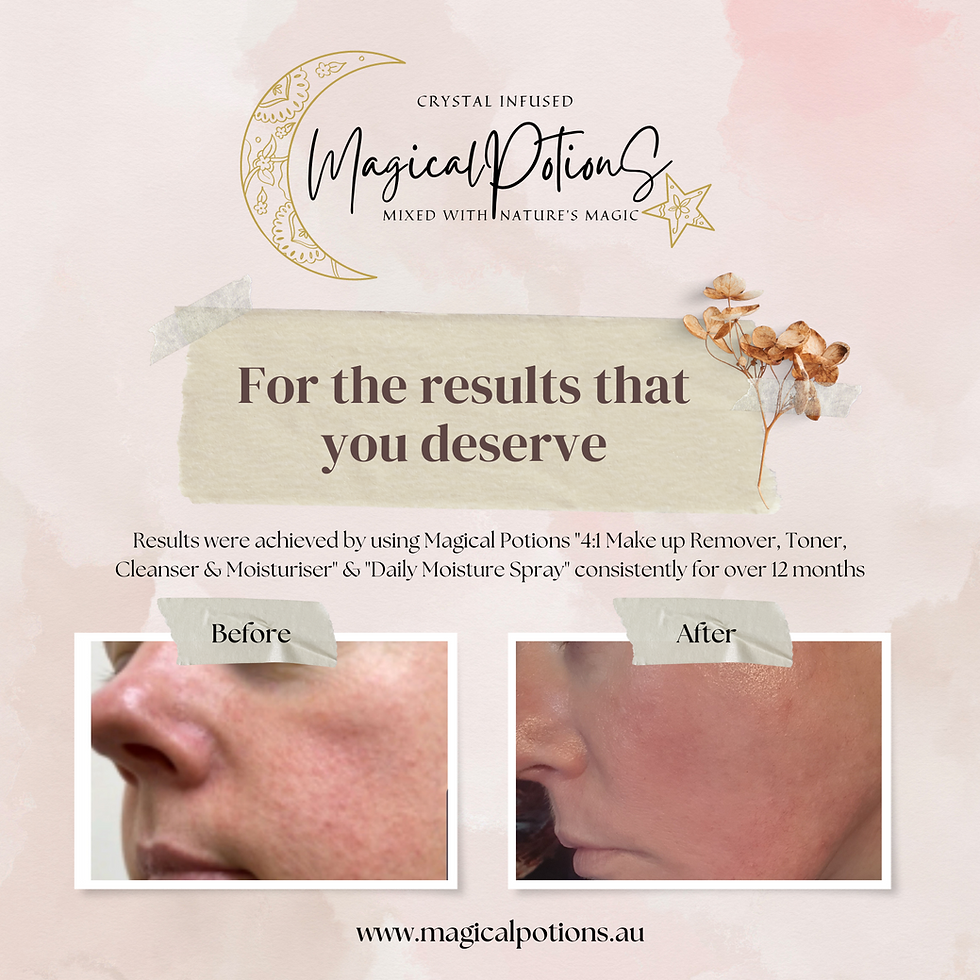 Thumbnail: Pamper Skin - Daily Moisturising Spray - Graceful Aging