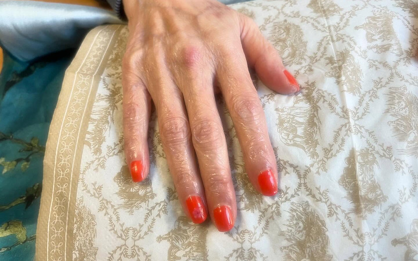 フィードバック