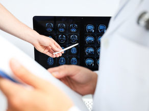 Vitória da neurocirurgia: gêmeas siamesas são separadas