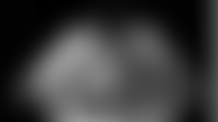 Forame Oval Patente – Do Diagnóstico ao TratamentoIntrodução