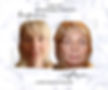 Face Lift Dr Dejan Milutinović