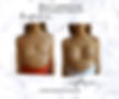 Breast Augmentation Belgrade Augmentation Mammaire Aumento del Seno