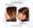 Rhinoplasty Dr Dejan Milutinović