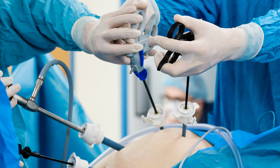 Hysterectomy