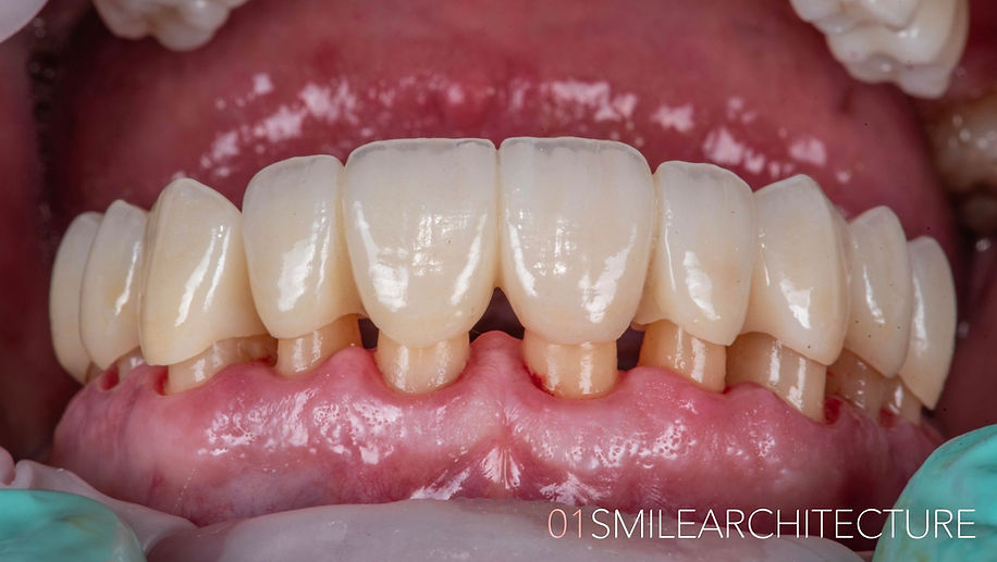 ARMONIA Postrado en Estética Dental Multidisciplinar.005.jpeg