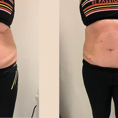 Side-by-side comparison of a person in black active wear