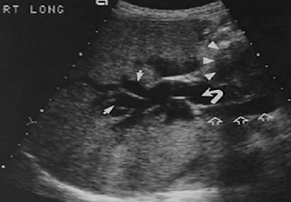 Biliary Tract Evaluation