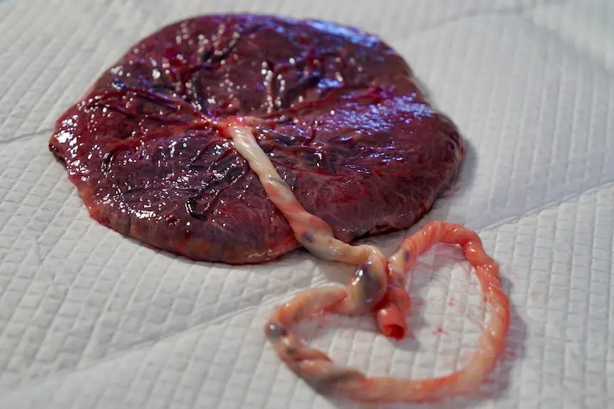 Evidence-Based Placenta Encapsulation: Benefits, Safety, and Options