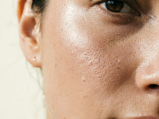 The latest research on skin neurotransmitter pathways! How does stress affect the skin?