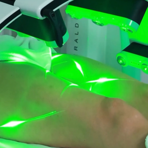 Green Emerald Laser 