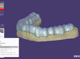 DentalCAD 3.3 Chemnitz: How AI‑Driven Digital Dentistry Workflows Are Reshaping Restorative and Implant Design