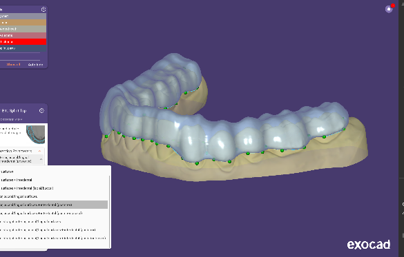 DentalCAD 3.3 Chemnitz: How AI‑Driven Digital Dentistry Workflows Are Reshaping Restorative and Implant Design