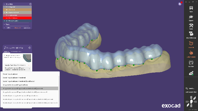 DentalCAD 3.3 Chemnitz: How AI‑Driven Digital Dentistry Workflows Are Reshaping Restorative and Implant Design