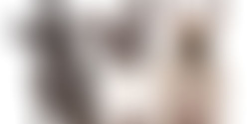 Cuidados necessários com os cães braquicefálicos