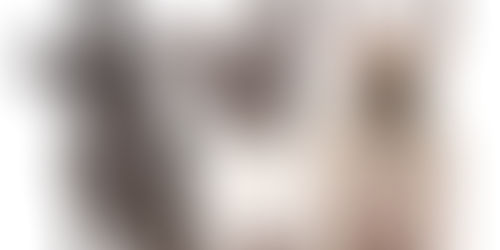 Cuidados necessários com os cães braquicefálicos