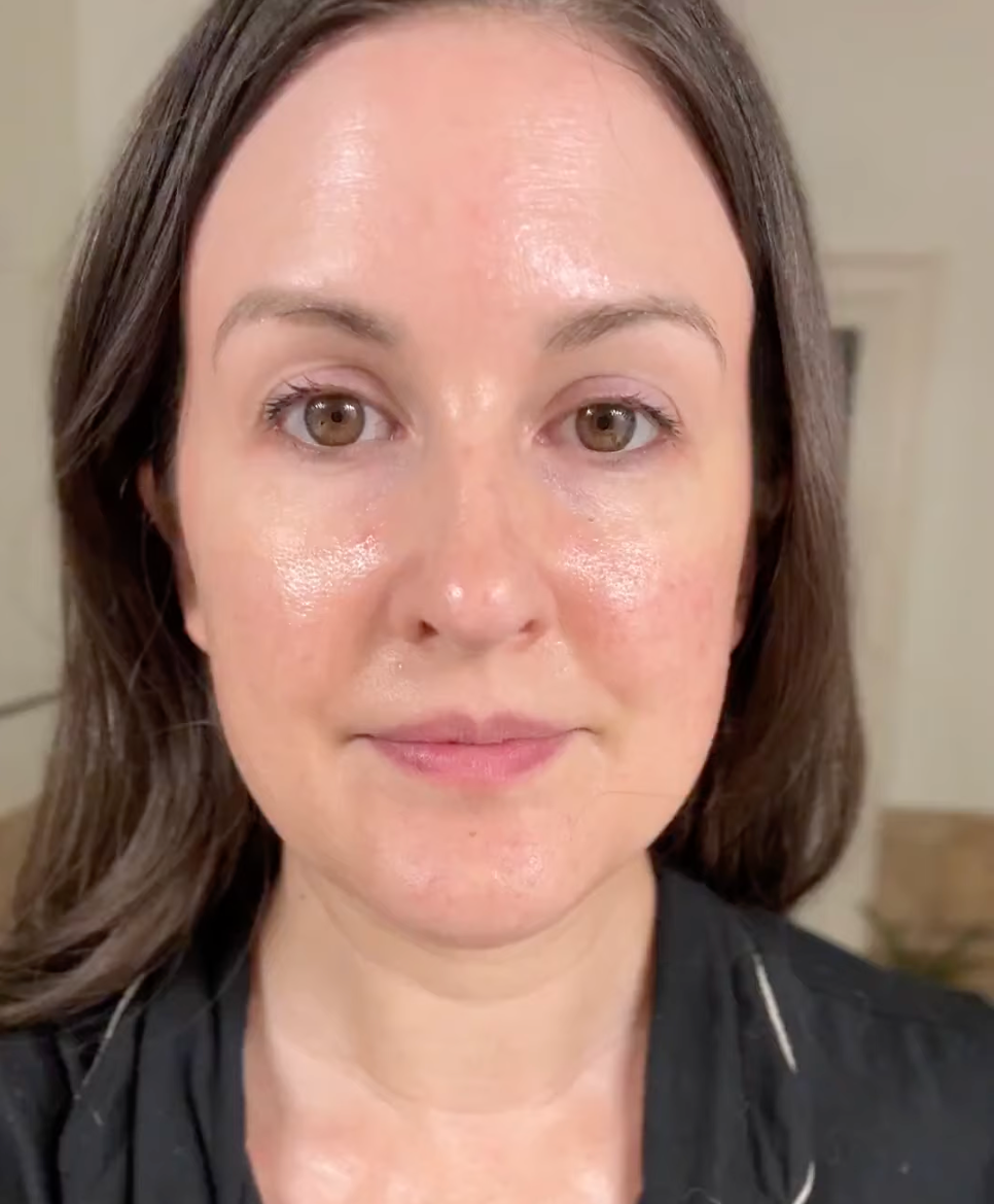The morning after using the Quasi collagen mask — no makeup, no filter, just glowing, dewy skin.