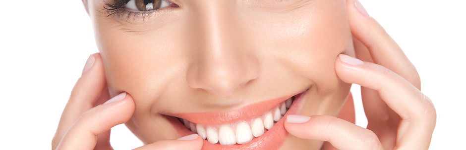 Sourire après un blanchiment dentaire