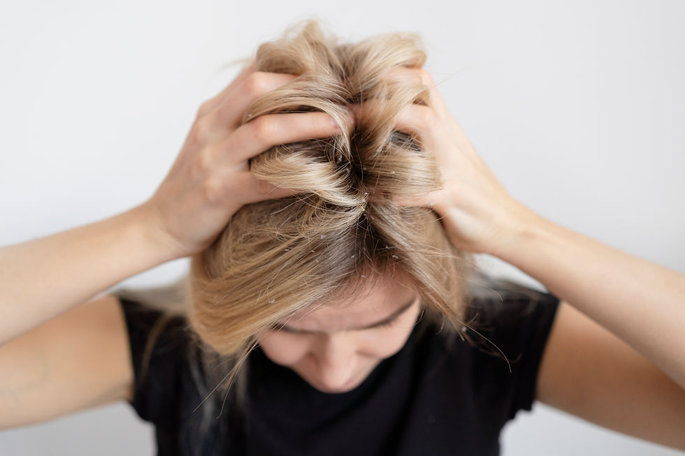 Blonde with Flakey Scalp
