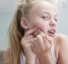 Does my son or daughter have to take medication to control their acne problem?