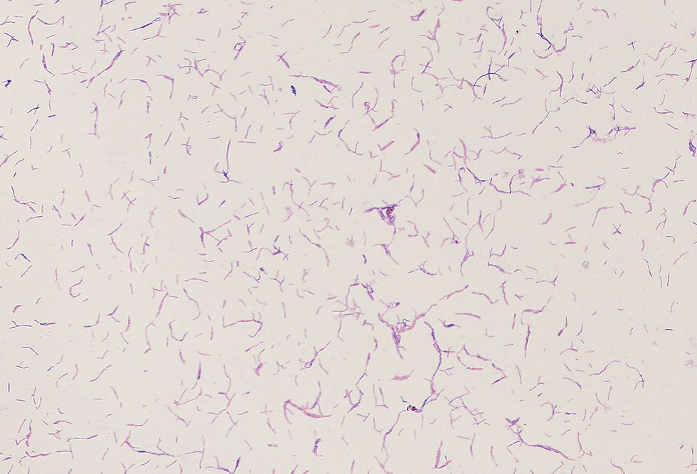 Lactobacillus ruminis GMB1277