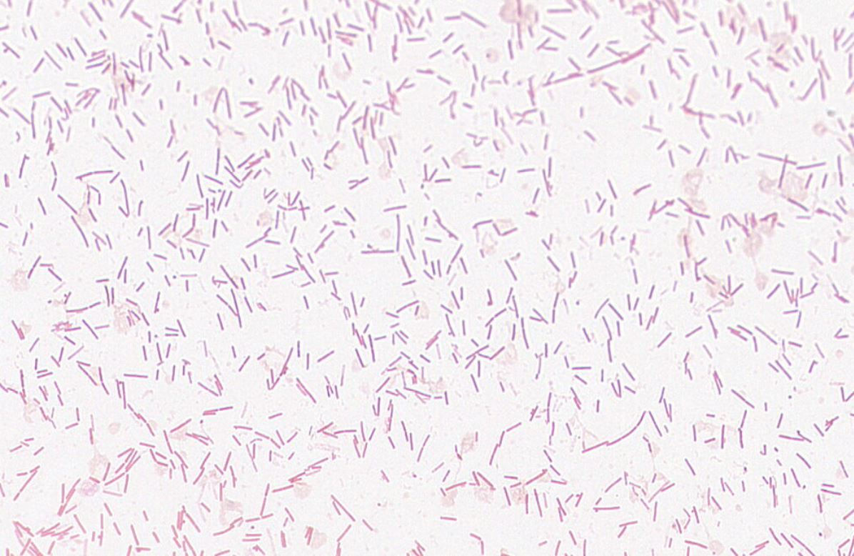 Bifidobacterium catenulatum  GMB1553