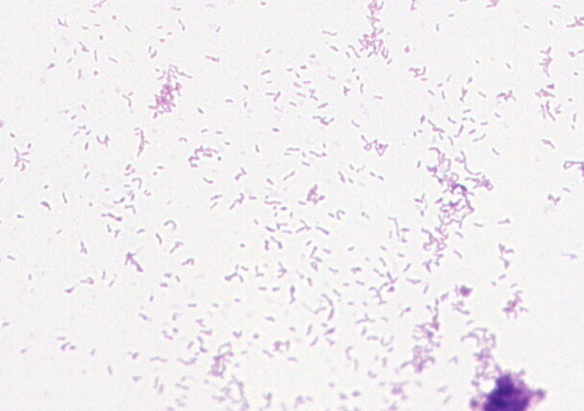 Propionibacterium acnes  GMB1558