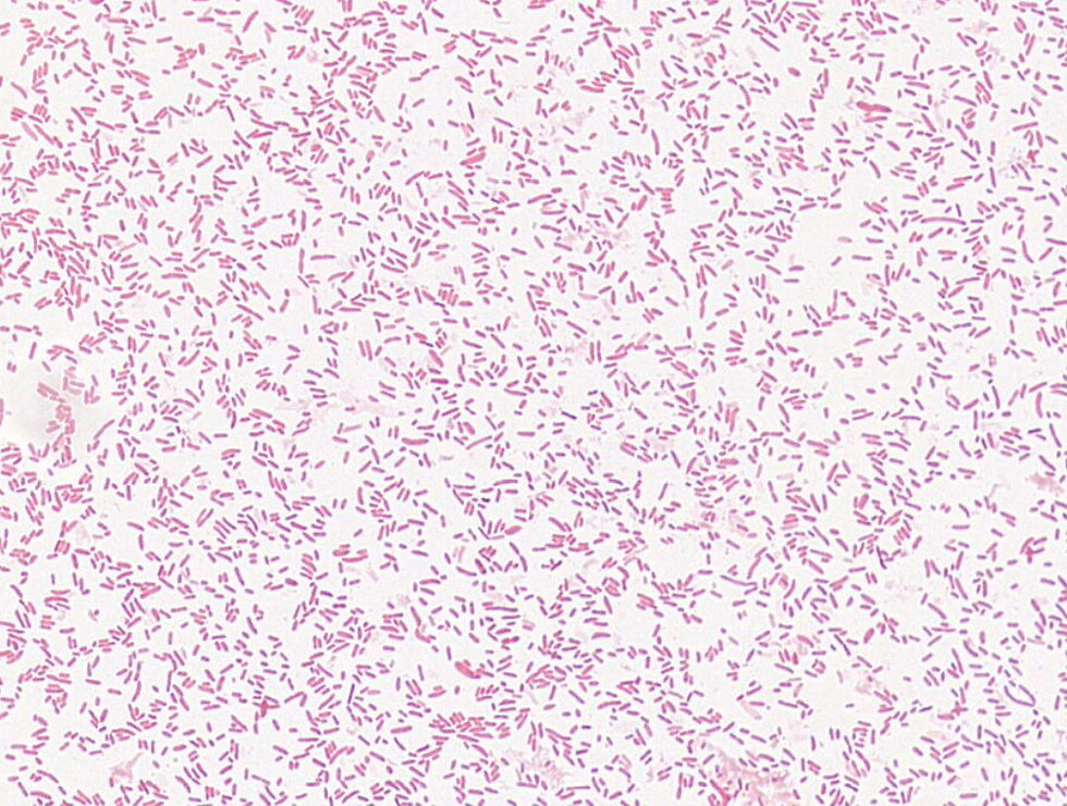 Edwardsiella sp. GMB1829