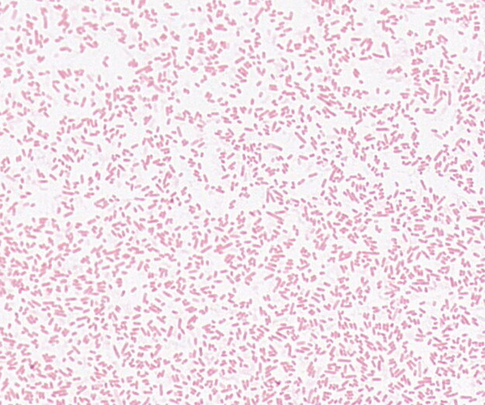 Escherichia sp. GMB2178