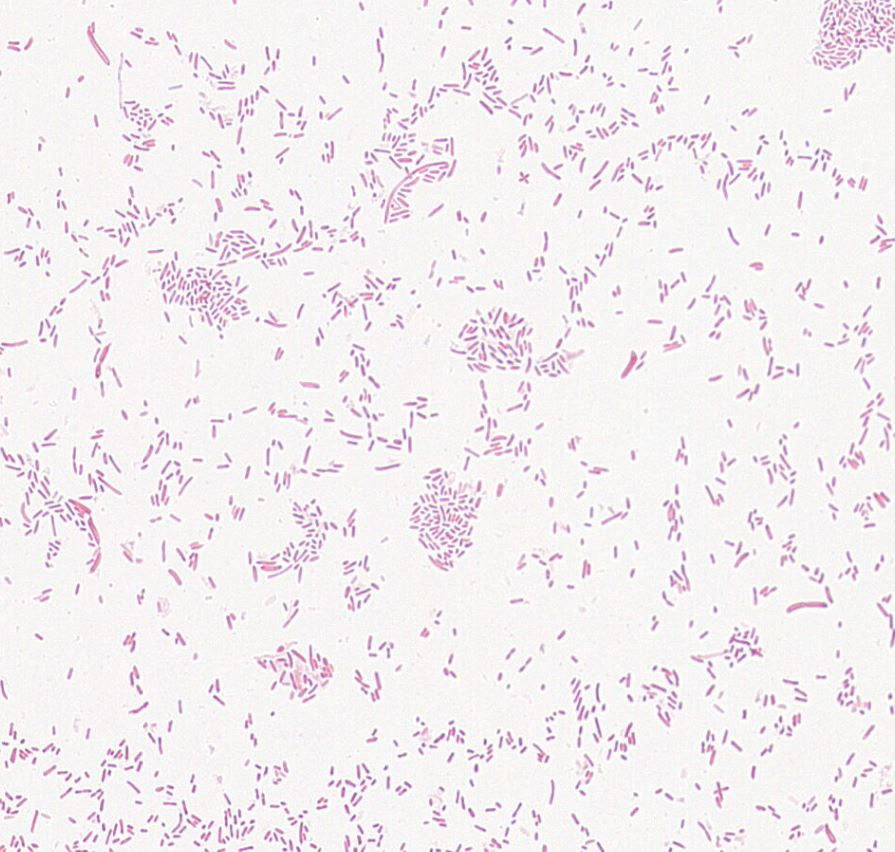 Edwardsiella tarda GMB0968