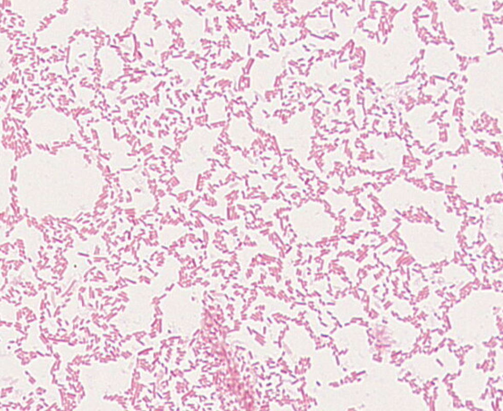 Plesiomonas sp. GMB1188