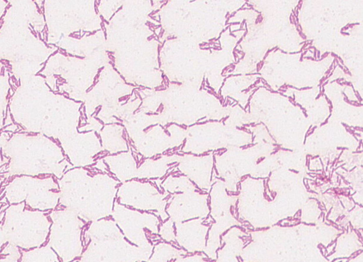 Trichosporon asteroides GMB0507