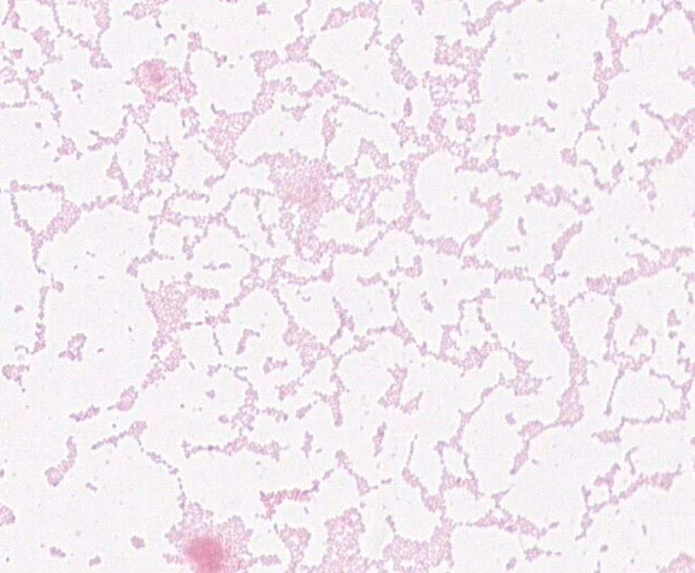 Achromobacter sp. GMB1407