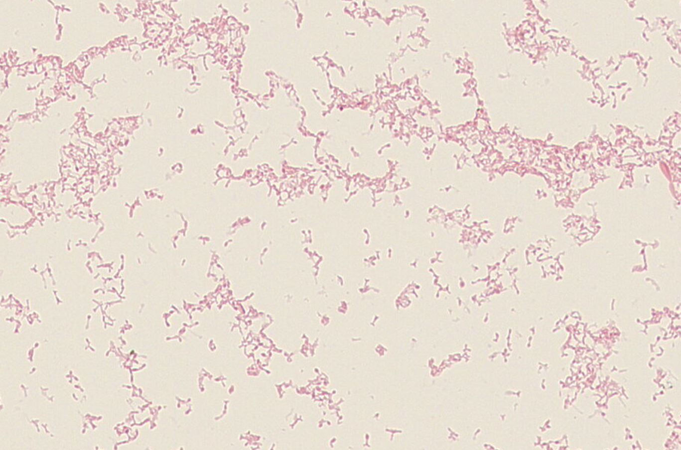 Bifidobacterium bifidum GMB1476