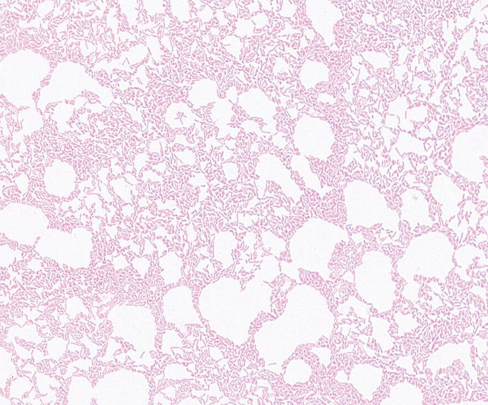 Bifidobacterium pseudocatenulatum GMB1809