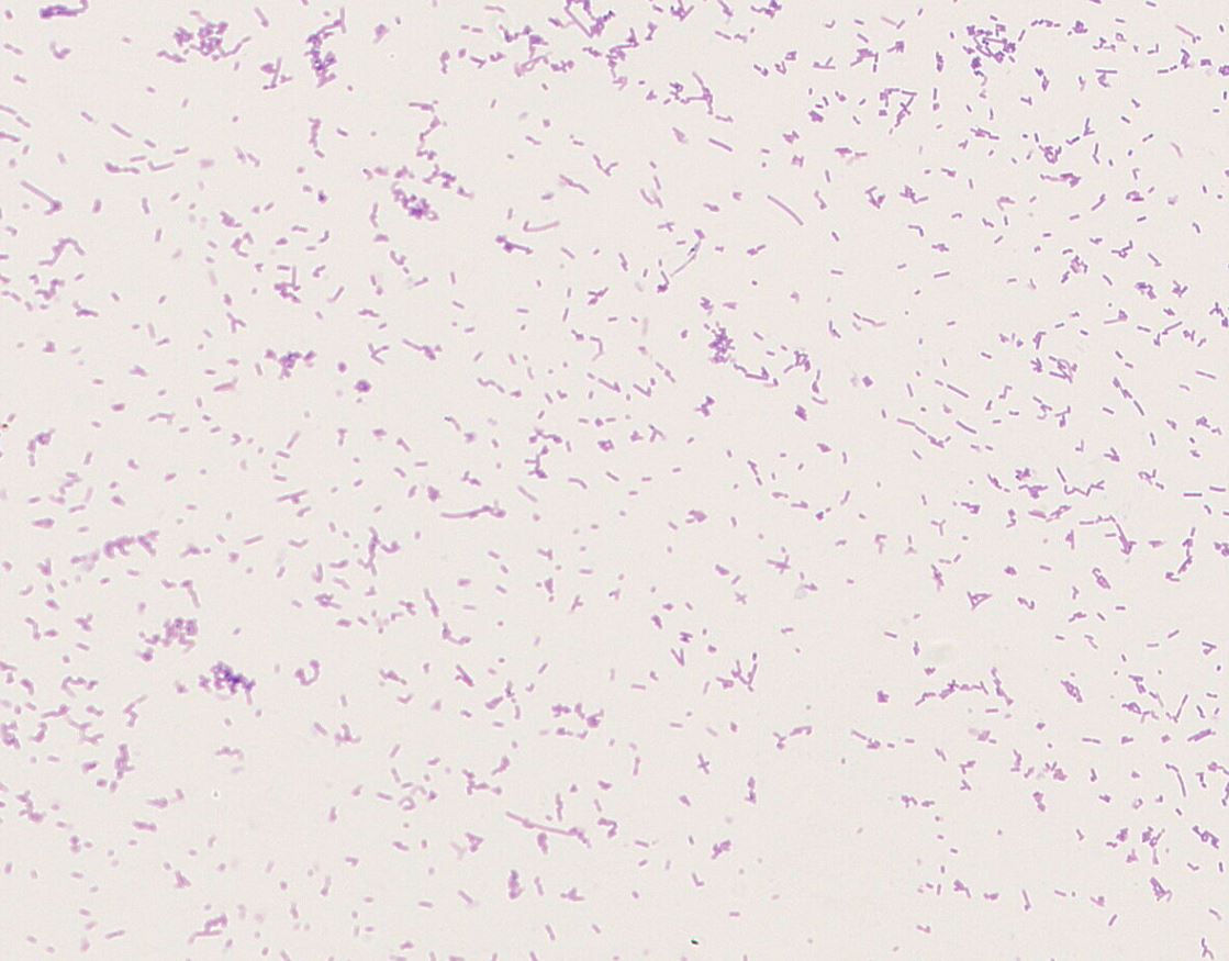 Lactobacillus reuteri  GMB1200