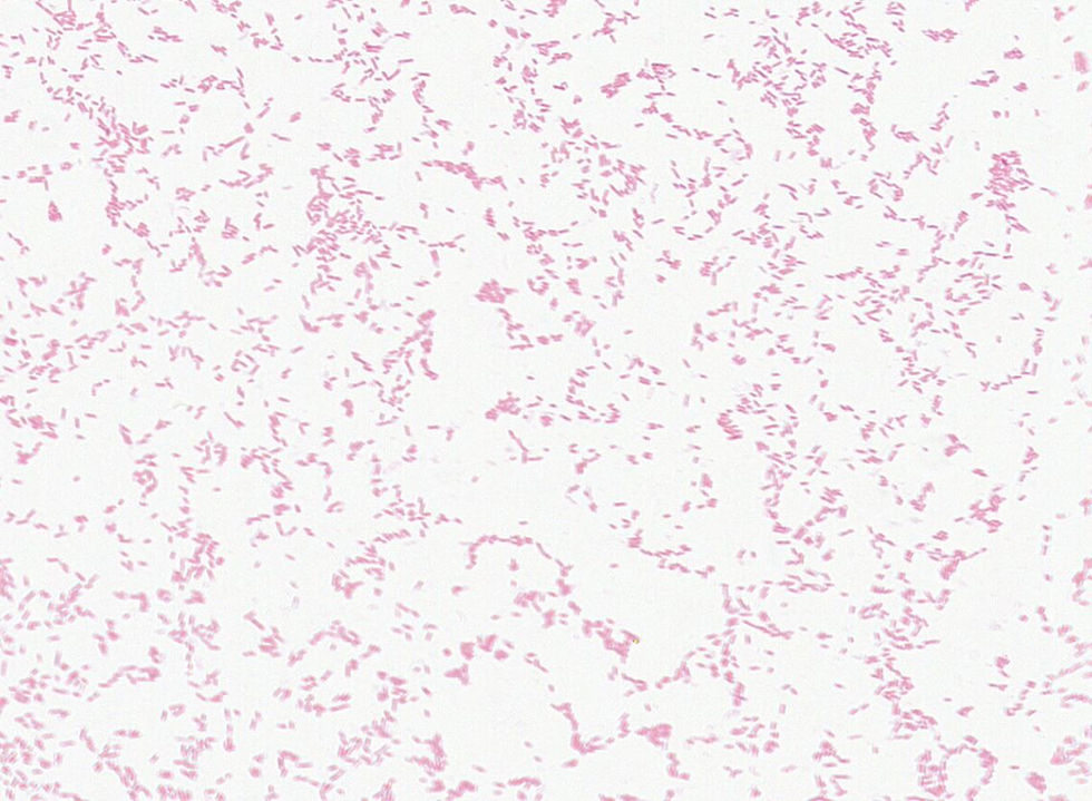 Escherichia sp. GMB1893