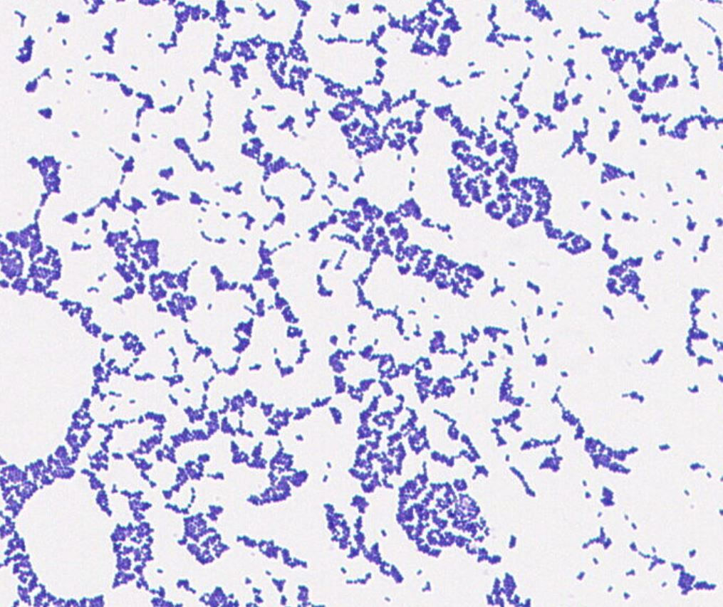 Acinetobacter sp.  GMB1068