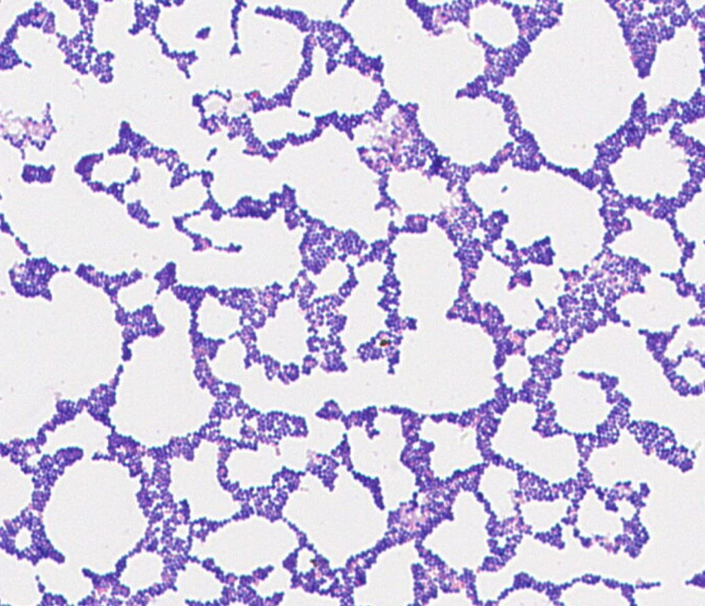 Enterococcus avium GMB1270