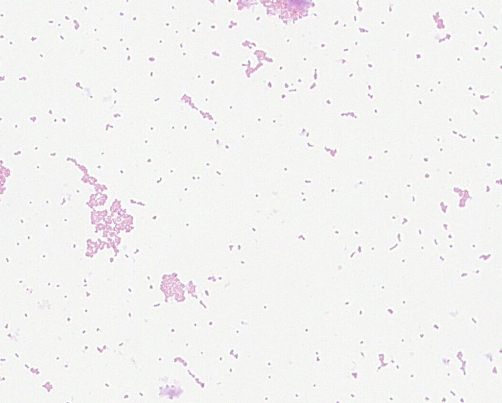 Streptococcus agalactiae GMB1044