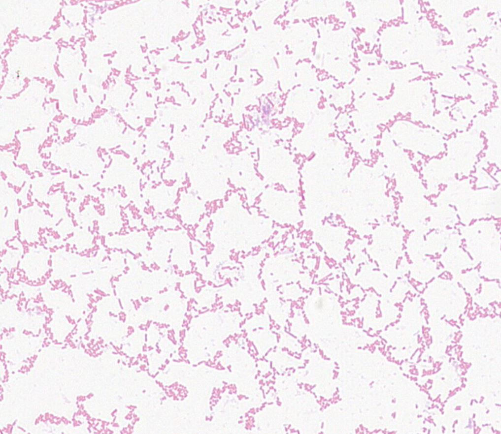 Citrobacter sp.  GMB1174