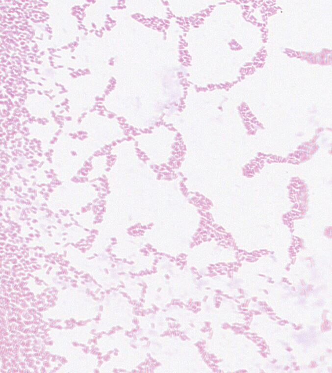 Escherichia sp. GMB2189