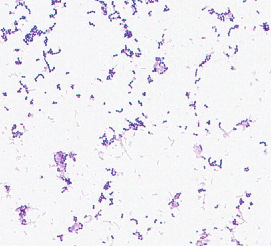 Streptococcus anginosus GMB0133
