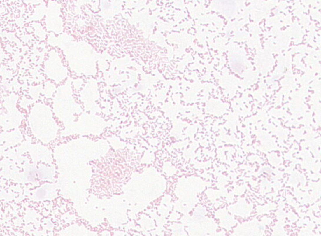 Alistipes putredinis GMB0345