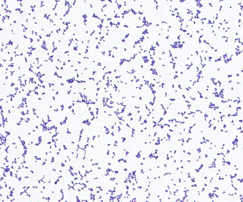 Rothia kristinae GMB0031 | GMBANK