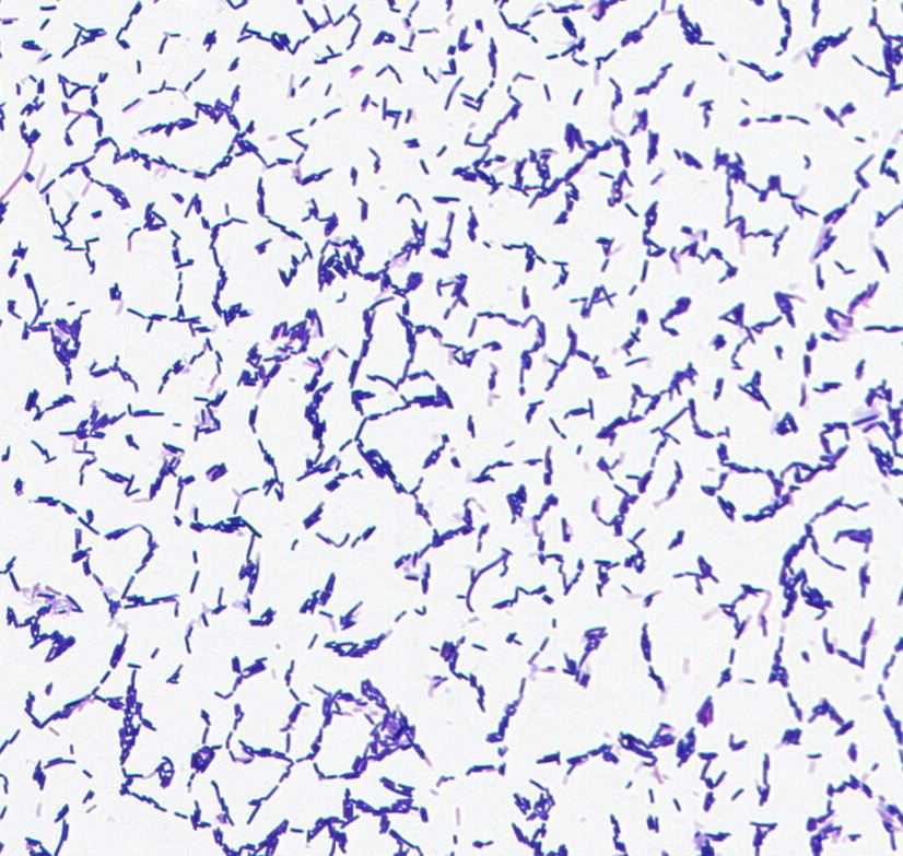 Lactobacillus sp. GMB2039