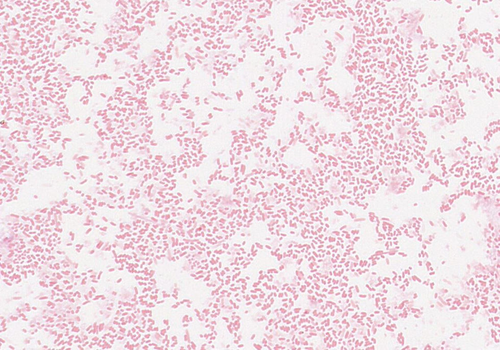 Edwardsiella sp. GMB1832