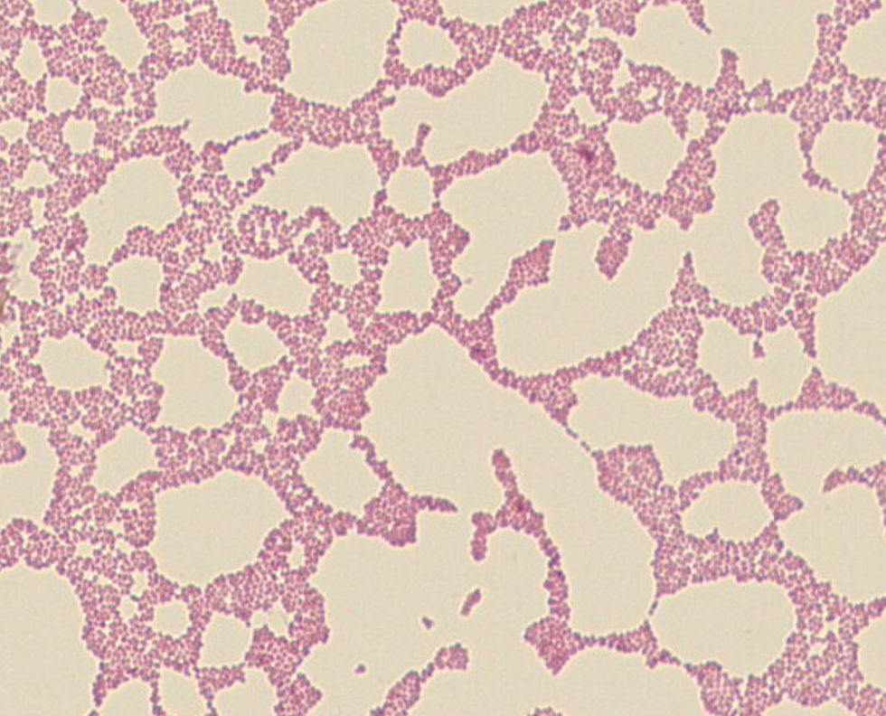 Lactococcus garvieae GMB0128