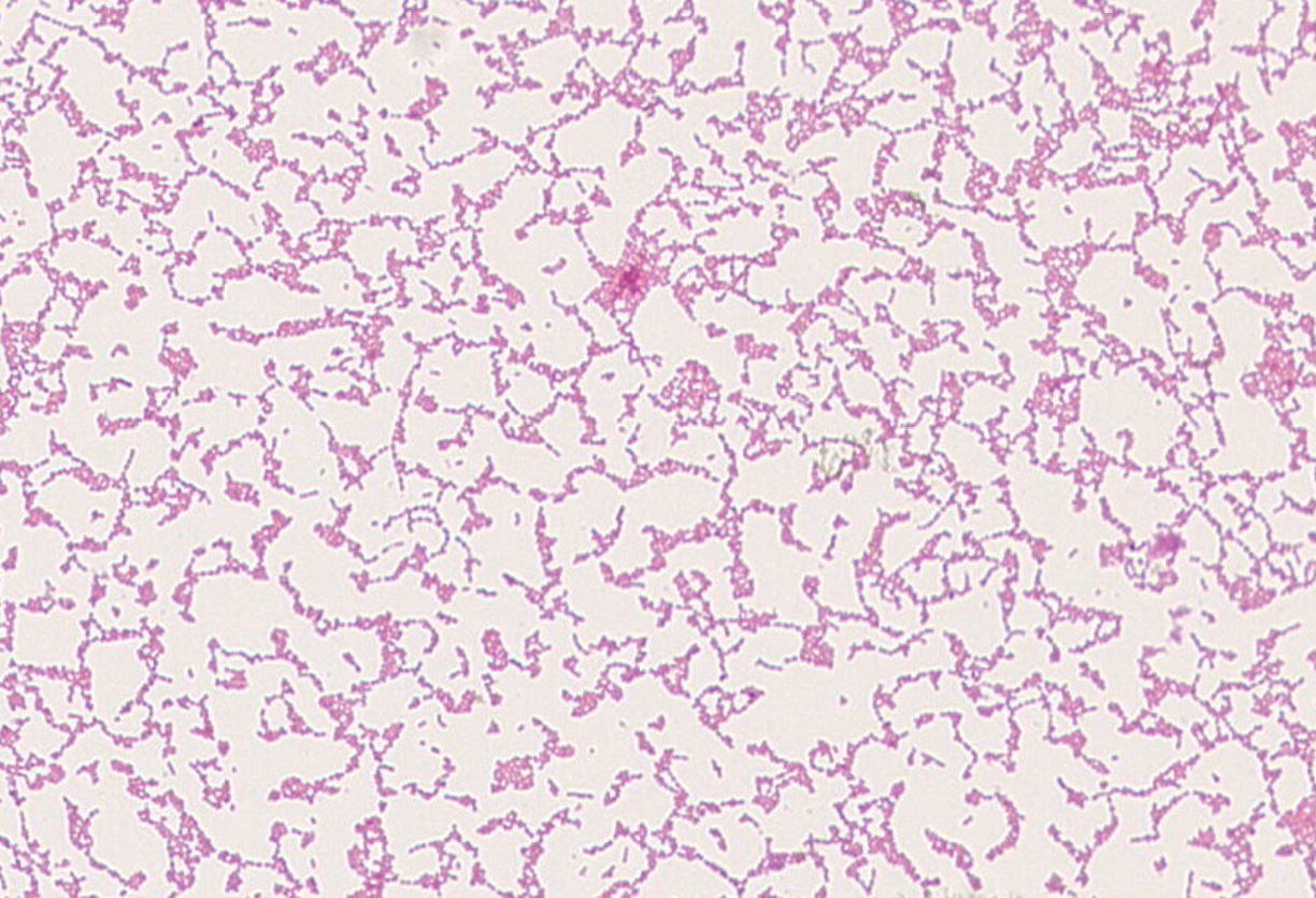 Streptococcus sanguinis GMB0795