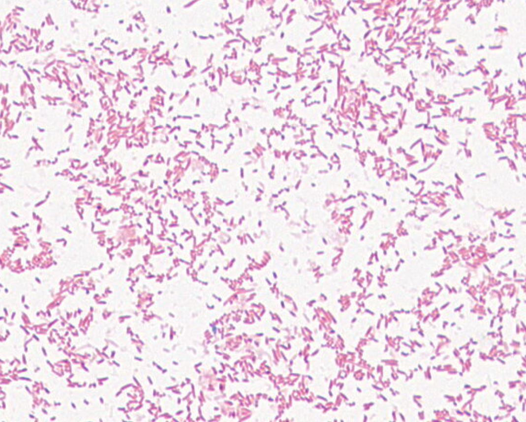 Uncultured organism  GMB1120